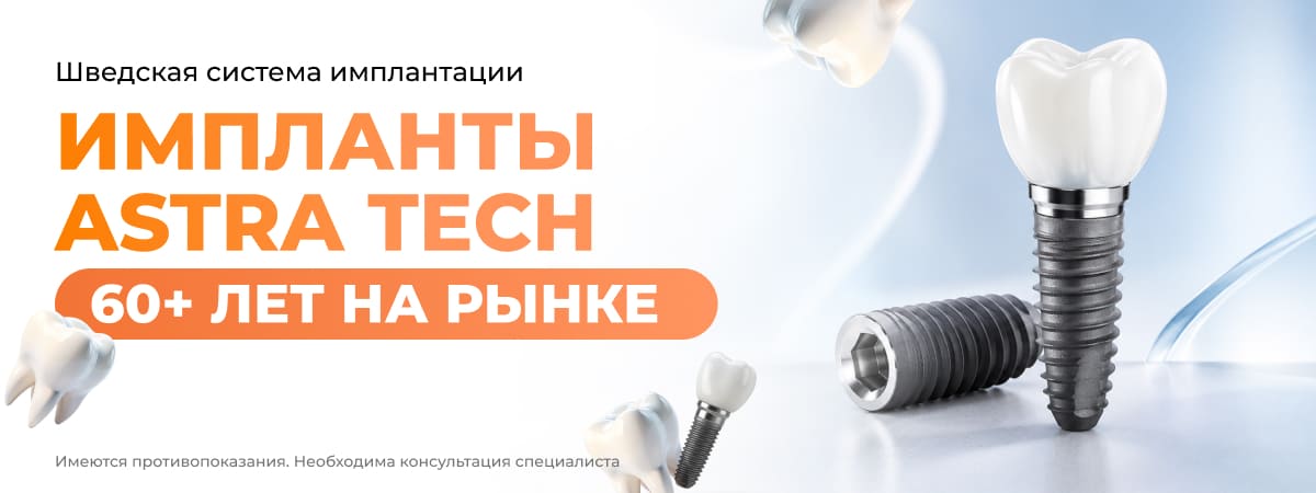 ASTRA TECH